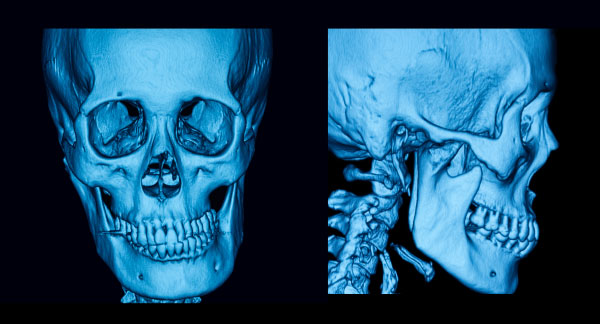 3D Facial Scanning in Lynnwood
