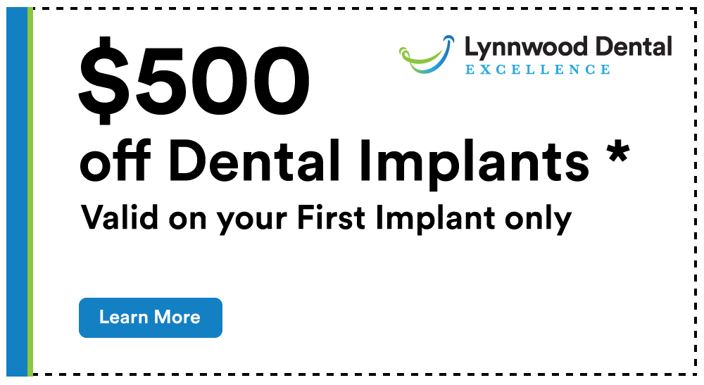 $500 Off Dental Implants